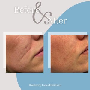 Huidzorg Laserklinieken Den Bosch image 1